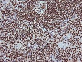 TRIM38 Antibody (clone OTI113D3)