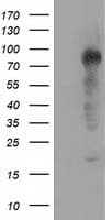 ERIC-1 / TACC3 Antibody (clone OTI3B1)
