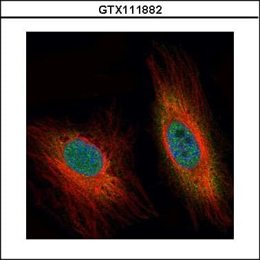 Polyclonal Rabbit anti-Human DEDD Antibody (aa129-223, WB)
