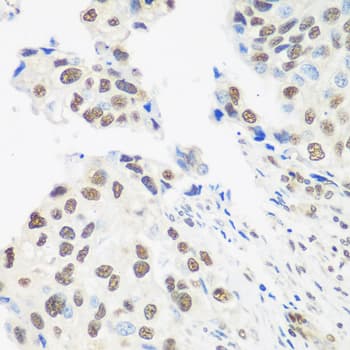DDX39B / UAP56 Antibody