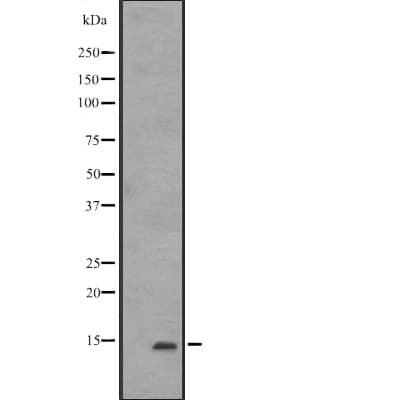 CD225 / IFITM1 Antibody