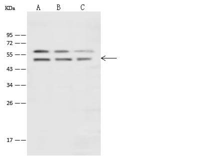 Polyclonal Rabbit anti-Human ENO1 / Alpha Enolase Antibody (Preservative Free, WB)