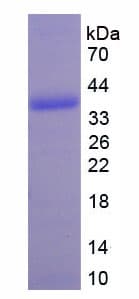 Human Metallothionein 2 Protein (Recombinant His-S)