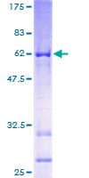 Human BRINP1 / DBC1 Protein (Recombinant GST)