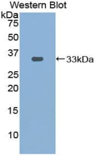 PDXK / PNK Antibody (aa29-285)