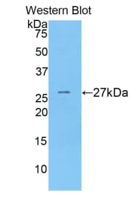 F9 / Factor IX Antibody (aa241-463, Cy3)