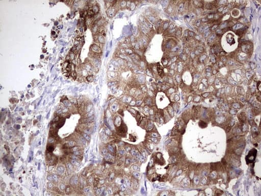LAMB3 / Laminin Beta 3 Antibody (aa424-773, clone OTI3A2)