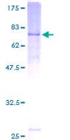 Human ACTR3 Protein (Recombinant GST)