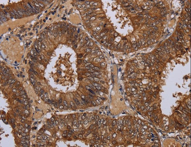 Polyclonal Rabbit anti-Human WDR83 Antibody (IHC)