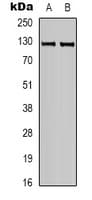 CACNA2D3 / Alpha-2/Delta-3 Antibody