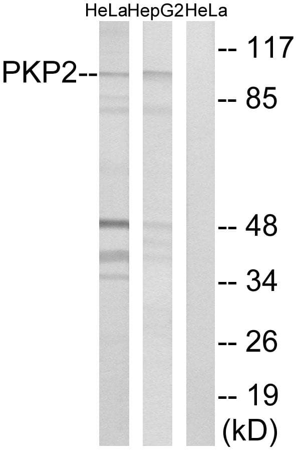 PKP2 / Plakophilin 2 Antibody
