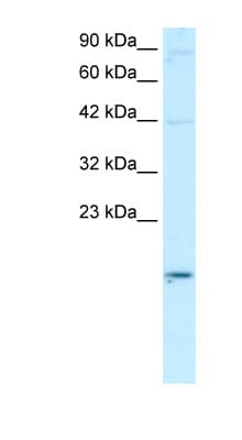 APOBEC3G / CEM15 Antibody (aa51-100)