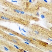 GPAM Antibody