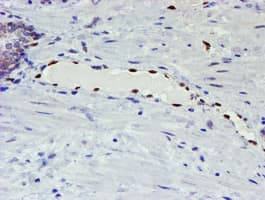 ELK3 / NET Antibody (clone OTI1H3)