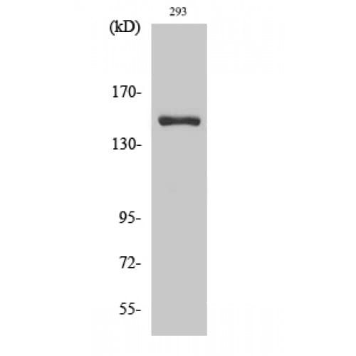 Polyclonal Rabbit anti-Human ANKRD30A / NY-BR-1 Antibody (1010-1090 aa, C-terminal, IHC, WB)