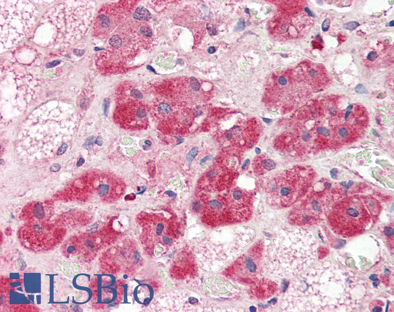 IHC-plus™ NT5E / eNT / CD73 Antibody (aa27-252, clone 2B6)