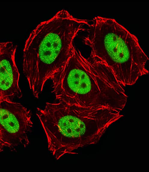 Polyclonal Rabbit anti-Human GLI2 Antibody (aa1287-1321, IF, WB)