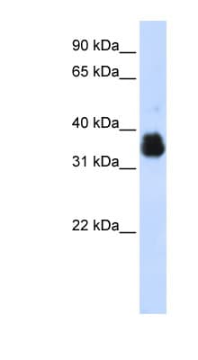 Polyclonal Rabbit anti-Human AIMP1 / EMAP II Antibody (aa108-157, WB)