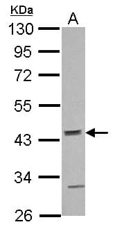 ACTR10 Antibody