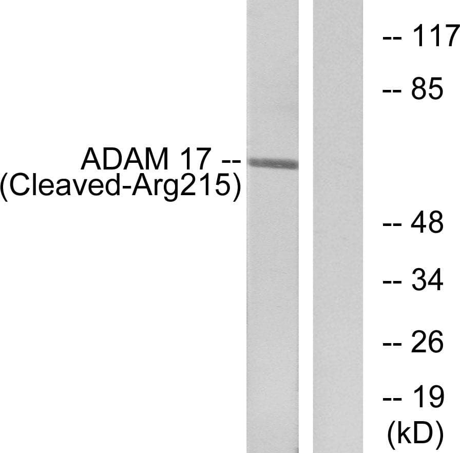 ADAM17 / TACE Antibody (Cleaved-Arg215)