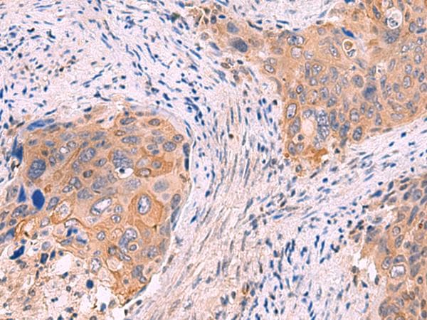 Polyclonal Rabbit anti-Human GSPT2 Antibody (IHC, WB)