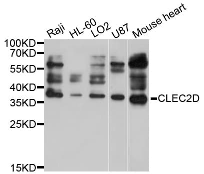 CLEC2D / OCIL / LLT1 Antibody