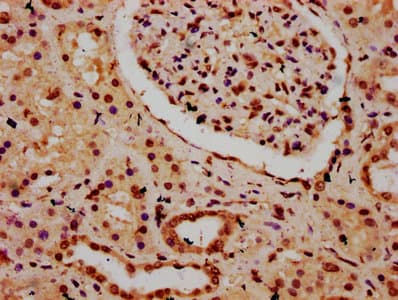 Polyclonal Rabbit anti-Human HIST1H3A Antibody (IHC, IF, WB)