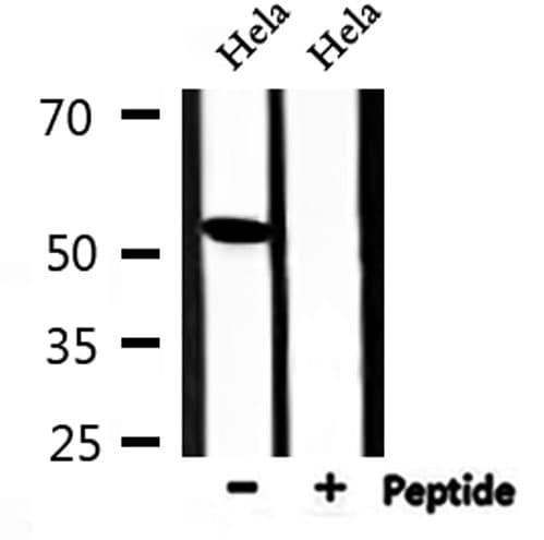 Polyclonal Rabbit anti-Human TINF2 Antibody (IF, WB)