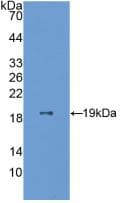 ESM1 / Endocan Antibody (aa20-184)