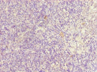 SIK3 / QSK Antibody
