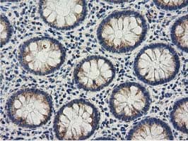 Monoclonal Mouse anti-Human AK3 / Adenylate Kinase 3 Antibody (clone OTI3G1, IHC, IF, WB)