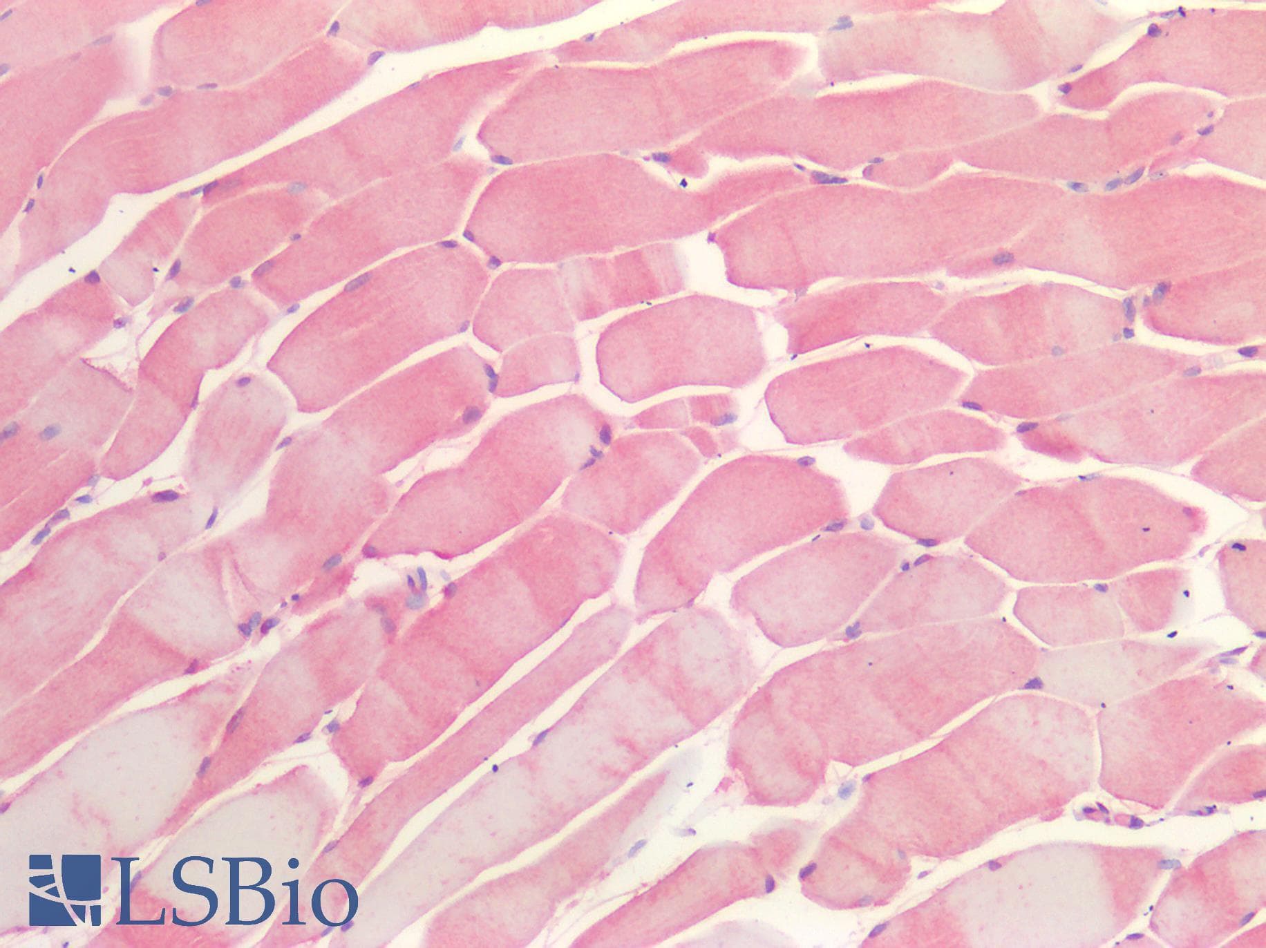 IHC-plus™ OSMR / IL-31R-Beta Antibody (clone 8F3H8B2)