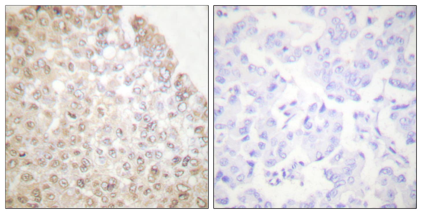 HDAC5 Antibody (aa1073-1122)