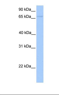 FOXO1 / FKHR Antibody (aa373-422)