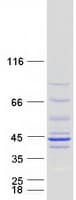 Human NDUFAF1 / CIA30 Protein (Recombinant Myc-DDK (Flag))