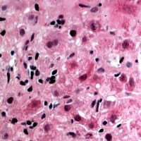 Polyclonal Rabbit anti-Human GK / Glycerol Kinase Antibody (N-Terminus, IHC, WB)