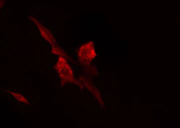 RPL7 / Ribosomal Protein L7 Antibody