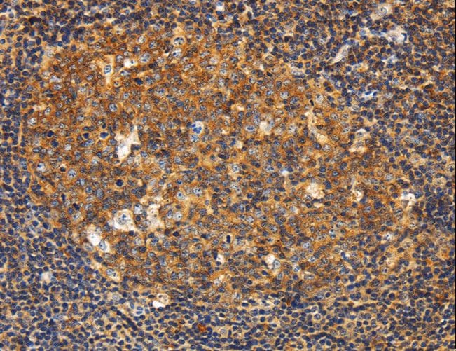 GNA13 Antibody