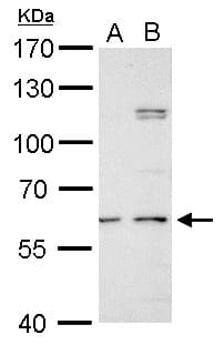 GALNS / Chondroitinase Antibody (aa20-259)