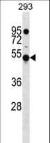 KLHDC4 Antibody (aa237-265)