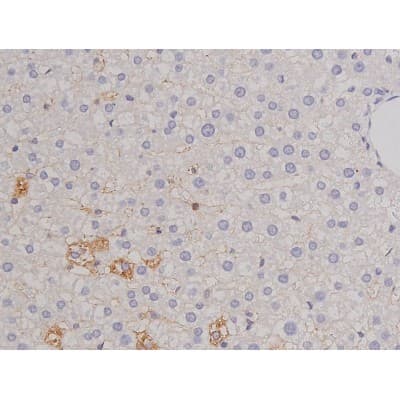 Polyclonal Rabbit anti-Human BCL2L1 / BCL-XL Antibody (phospho-Thr47, IHC, IF, WB)