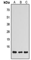 NDUFS5 Antibody (Internal)