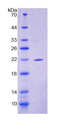 Human SBSN Protein (Recombinant His-T7)