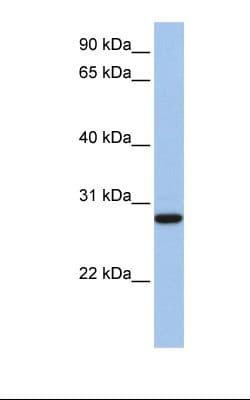 VDAC3 Antibody (aa74-123, HRP)