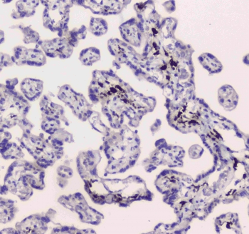 Polyclonal Rabbit anti-Human CD209 / DC-SIGN Antibody (IHC, WB)