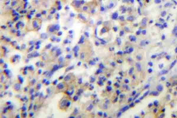 TPH1 / Tryptophan Hydroxylase Antibody (Val256)