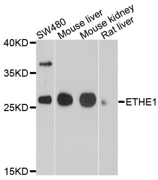 Polyclonal Rabbit anti-Human ETHE1 Antibody (WB)