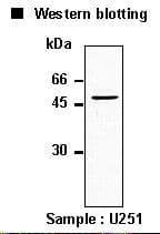 GFAP Antibody (clone MO389)