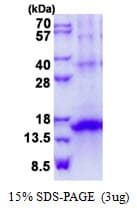 Human KLRG1 Protein (Recombinant His)