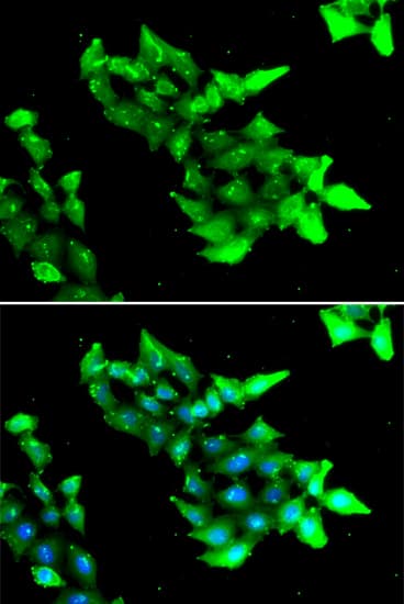 CCM1 / KRIT1 Antibody